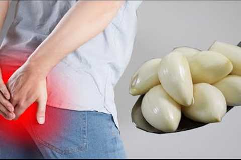 Incredible! It KILLS hemorrhoids without surgery! Cure swollen hemorrhoids in just one day